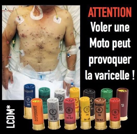 varicelle.jpg